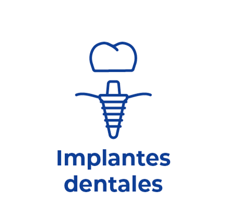 Implantes dentales